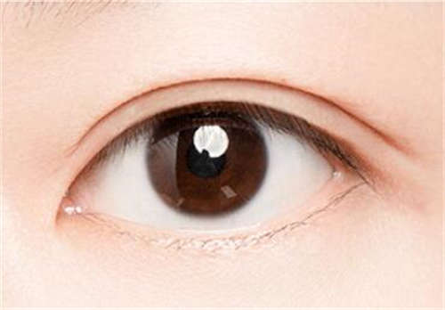 眼睑整形保持多长时间「眼睑下至眼睛会大多少」